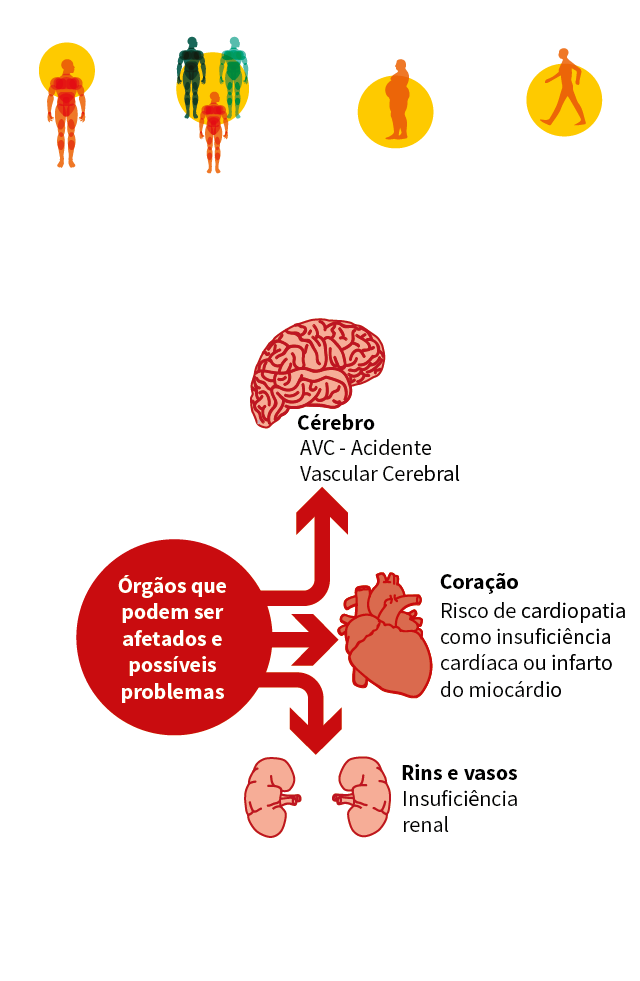 Infarto: sintomas, o que causa e como prevenir - Minha Vida