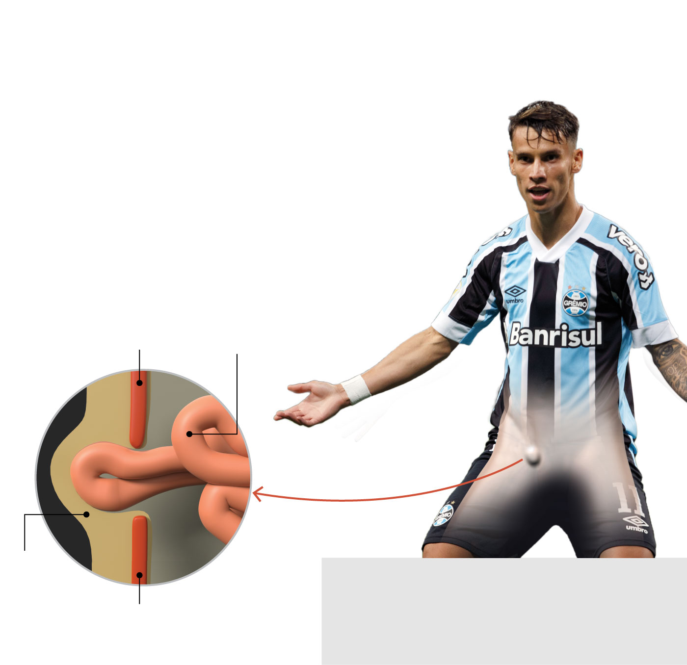 Grêmio informa que Ferreira terá que passar por cirurgia de hérnia